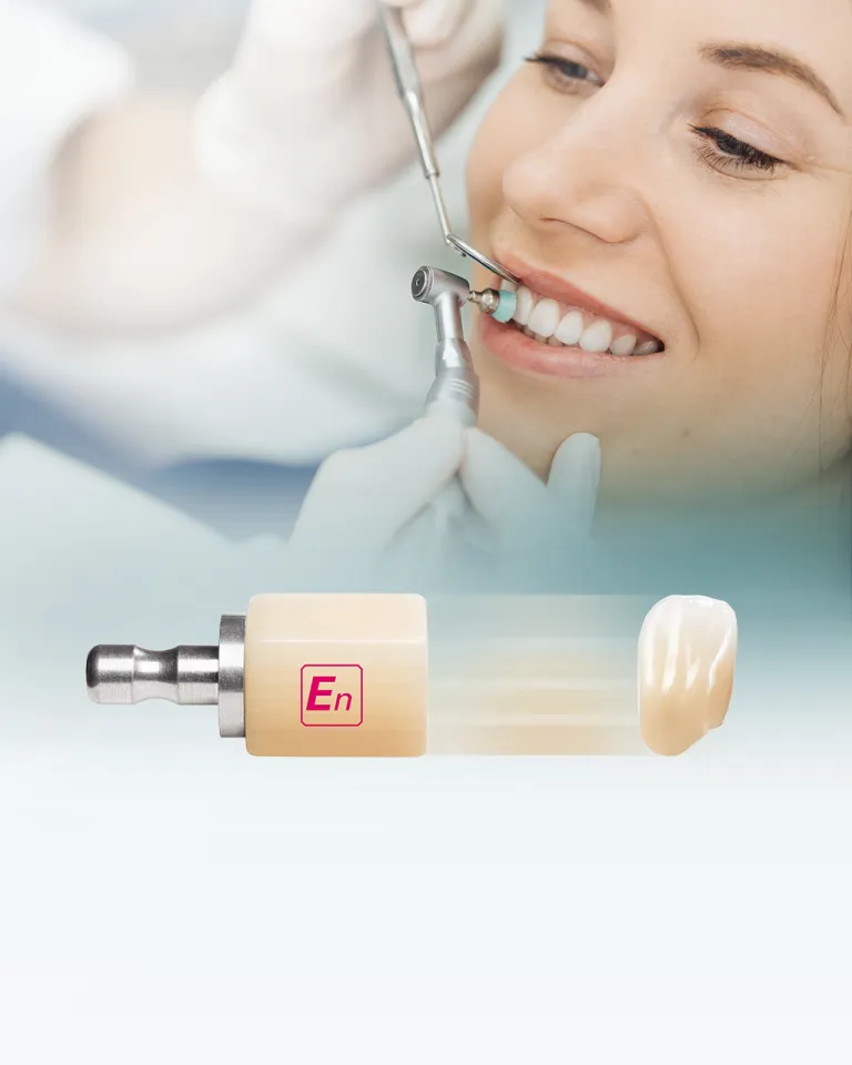 Ein strahlendes Patientenlächeln während der Behandlung mit VITA ENAMIC verdeutlicht den Erfolg von DOTS bei der Einführung und Vermarktung innovativer Dentalprodukte, kombiniert mit strategischem Kampagnenmanagement und kreativer Konzeption.